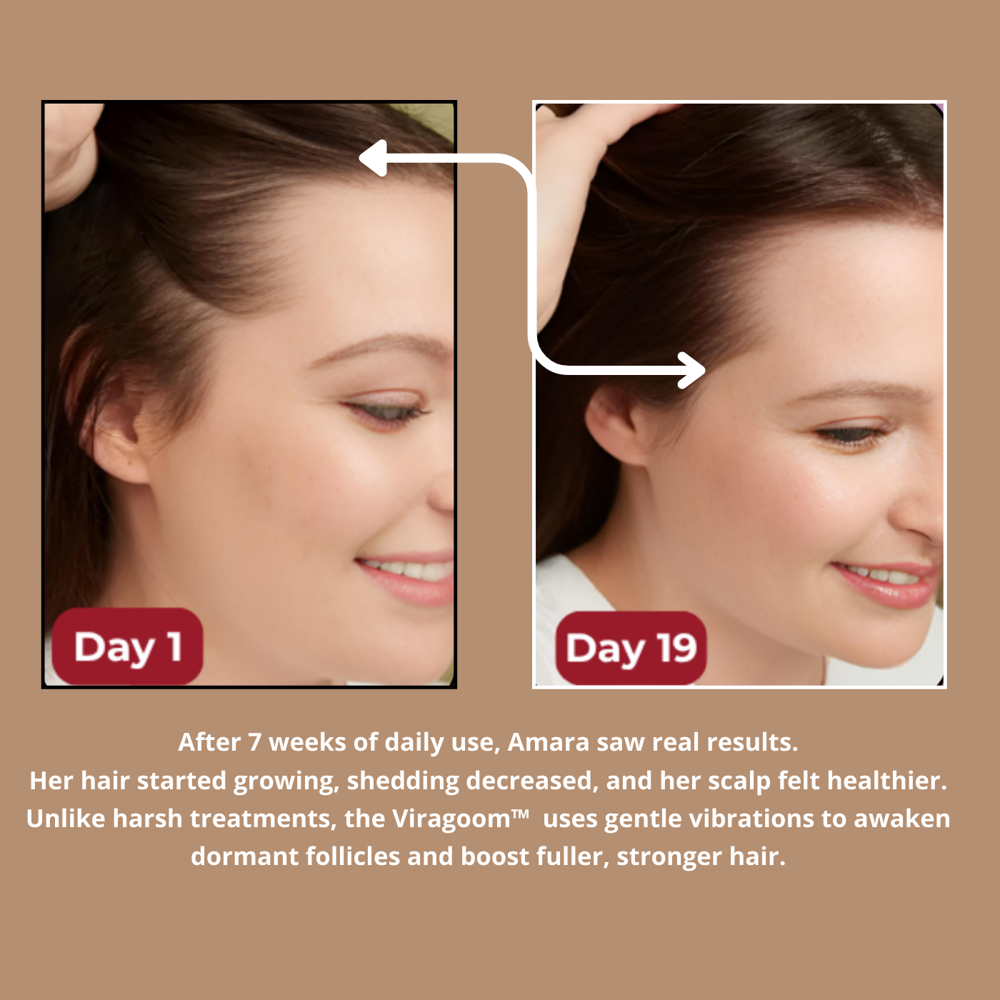 Viragoom™ - Massage Scalp