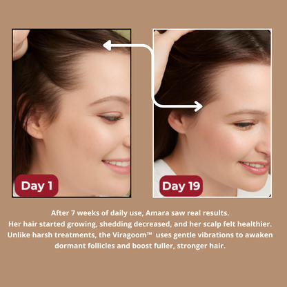 Viragoom™ - Massage Scalp