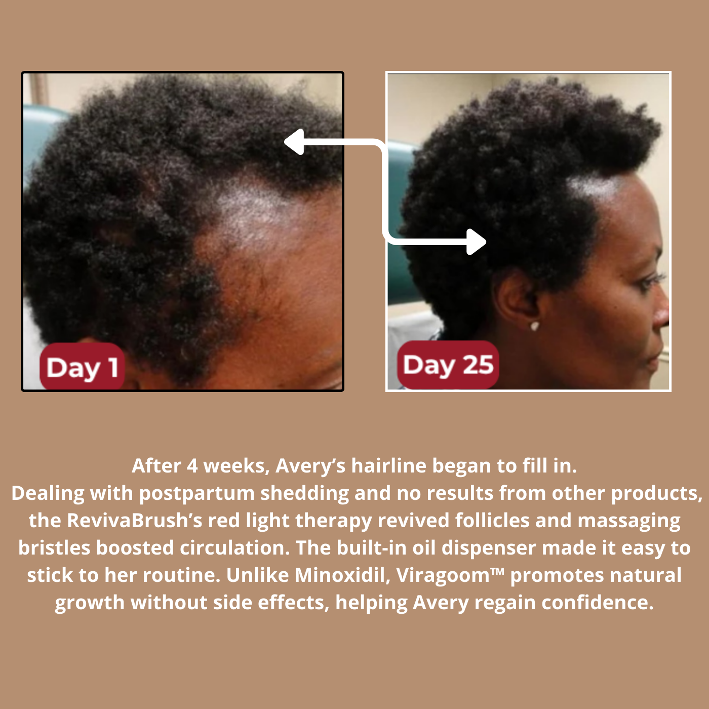 Viragoom™ - Massage Scalp