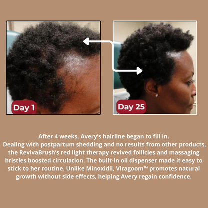 Viragoom™ - Massage Scalp
